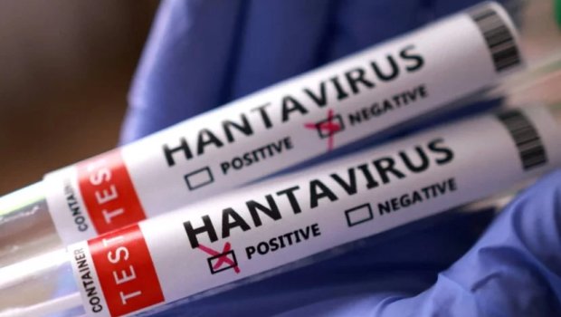 Venesuelada hantavirus həyəcanı: Ölənlər var
