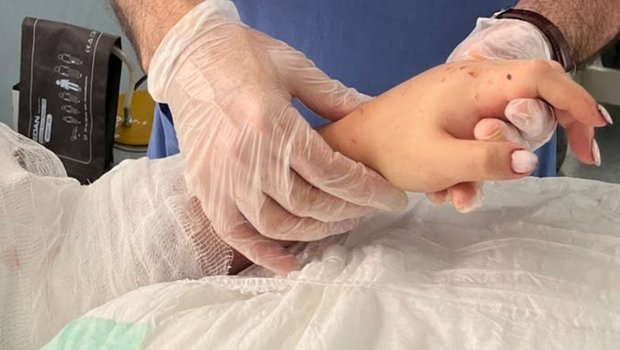 Bakıda qızın qopmuş qolu yerinə bərpa olundu- Foto