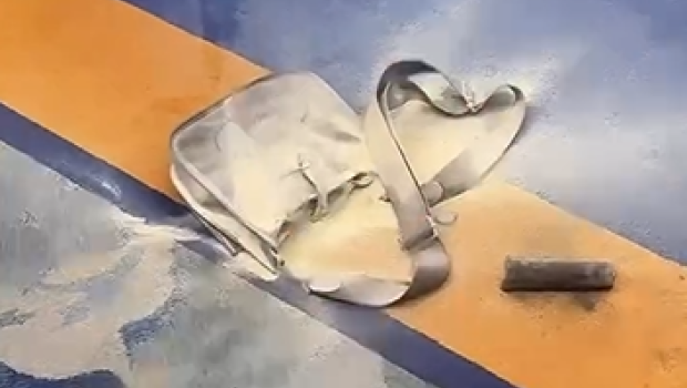 Anar Ağakişiyevin çantasında &ldquo;powerbank&rdquo; partladı - Xəsarətlər aldı - VİDEO