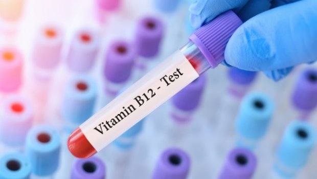 Qanında B12 vitamini yüksək olanlara XƏBƏRDARLIQ