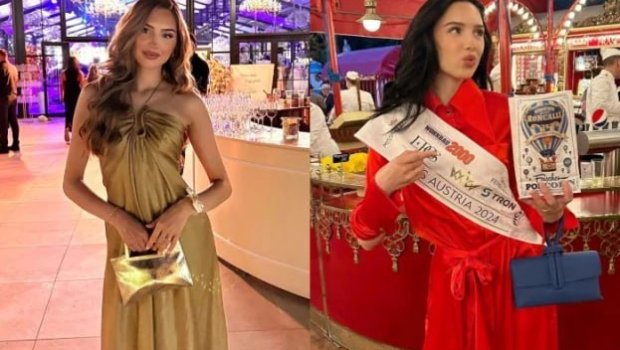 7 dəfə əməliyyat keçirən model VƏFAT ETDİ