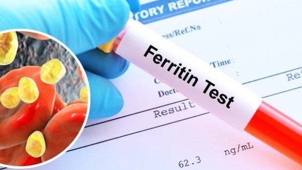Əksəriyyətin ferritin haqqında bilmədiyi VACİB MƏLUMAT