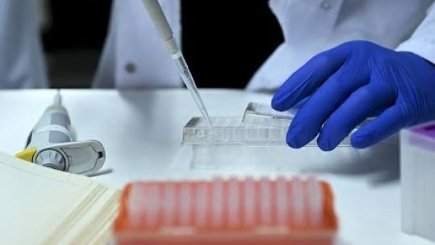 Türkiyədə xərçəng müalicəsi üçün &ldquo;ağıllı&rdquo; dərman sistemi hazırlanacaq