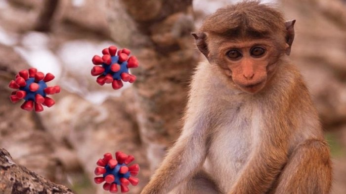 &ldquo;Meymunçiçəyi&rdquo; QAPIDA &ndash; Azərbaycanda bu virusa YOLUXAN var? -RƏSMİ AÇIQLAMA